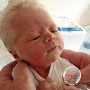 Baby mocked for having white hair – years later, he looks perfectly happy and healthy.