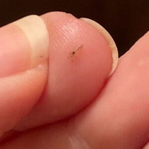 What is this? Is this lice? Only one came out of my hair