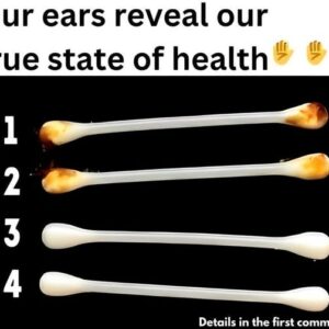 Our ears reveal our true state of health