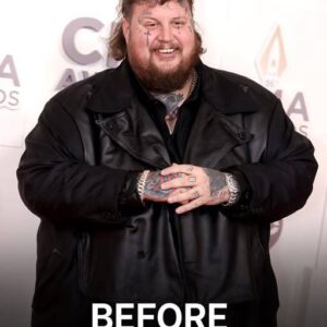 Country Singer Jelly Roll Shed 100 Pounds – Wait Till You See How He Looks Now…