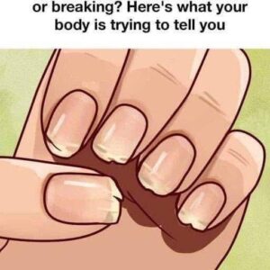 Doctor Reveals 7 Health Issues Hidden in Your Nails