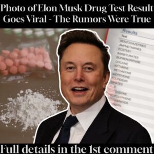 Photo of Elon Musk Drug Test Result Goes Viral – The Rumors Were True